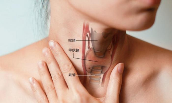 疲倦、莫名变胖，可能是甲状腺低下！小心5族群风险高