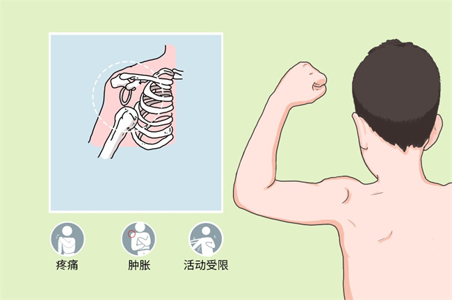 应该怎样避免孩子经常脱臼的问题