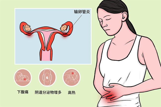 急性附件炎是什么原因导致的