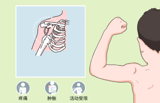 让脱臼恢复更快的饮食方法