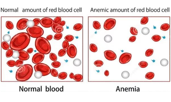 患者出现小细胞低色素贫血有哪些原因