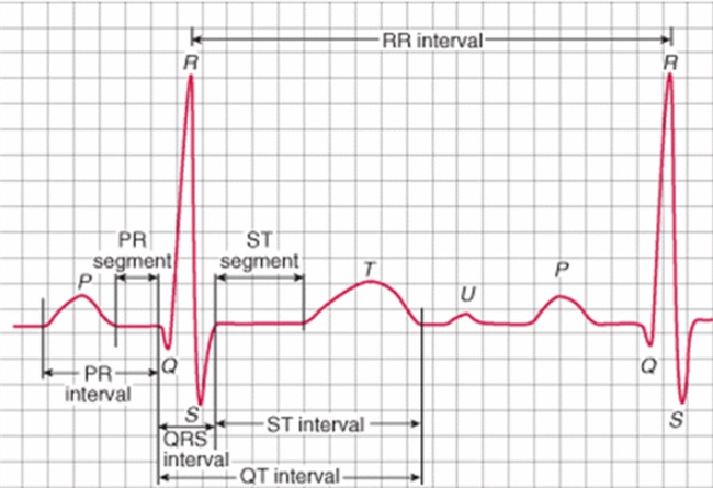 正常心电图的界定和个体差异：关键指标和进一步检查的重要性