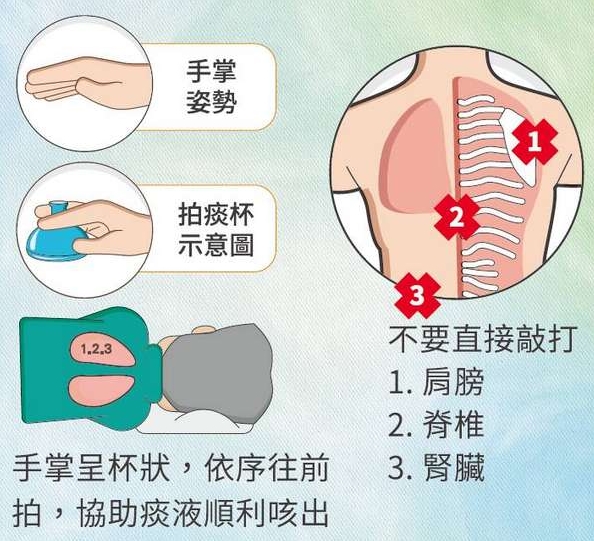 肺部痰液清除方法及原因分析