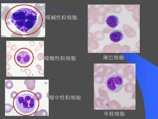 淋巴细胞高的原因及应对方法：了解免疫系统的重要性