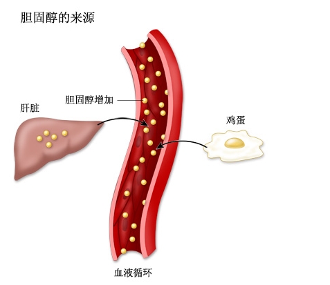 甘油三脂高？了解背后的健康风险与应对方法