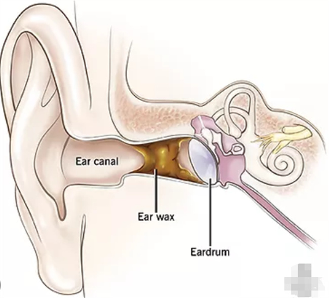 耵聍的作用与清理方法