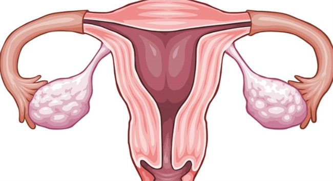专家解读：了解卵巢过度刺激综合症及其症状