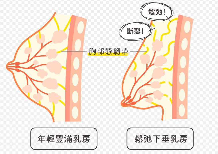 生完孩子奶头为何变粉？了解三大原因