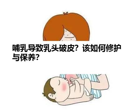 哺乳导致乳头破皮？该如何修护与保养？