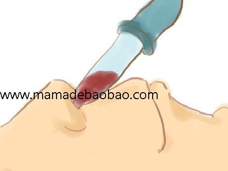 3种方法来在不伤害自己的情况下流鼻血（抹开的或干的鼻血）