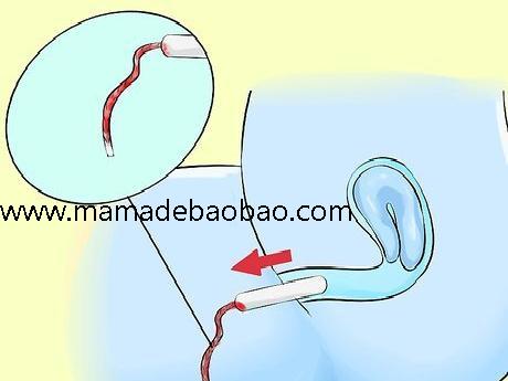 如何取出卫生棉条: 15 步骤（判断何时更换卫生棉条）