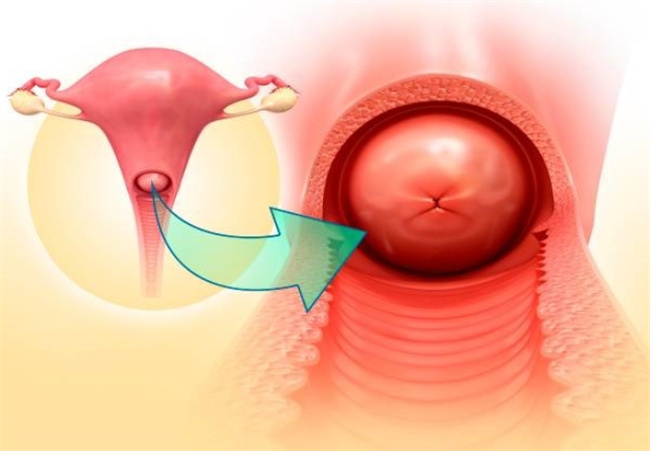 了解宫颈软硬的意义：妇科健康不容忽视